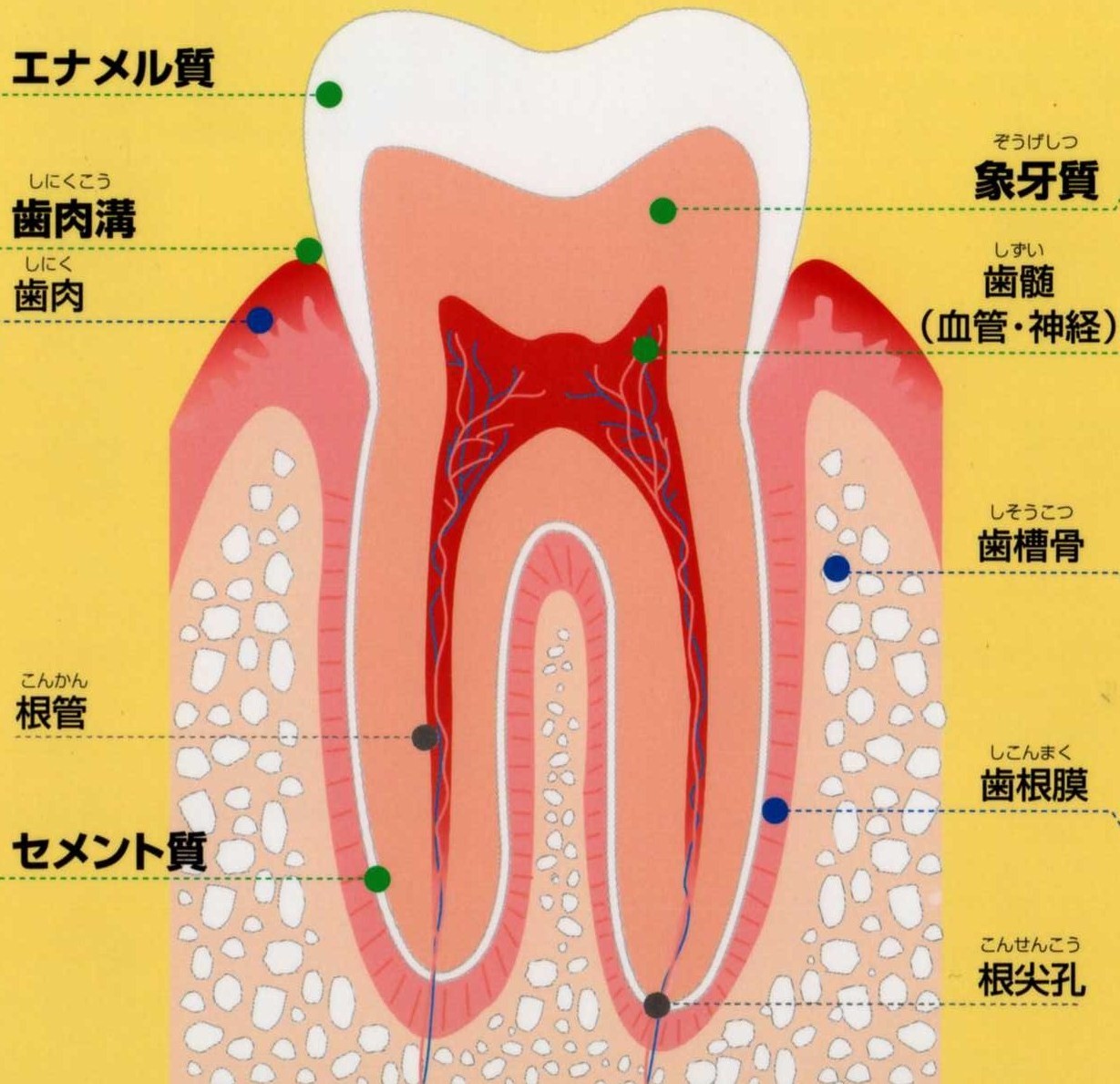 歯 の 神経 を 抜く と どうなる